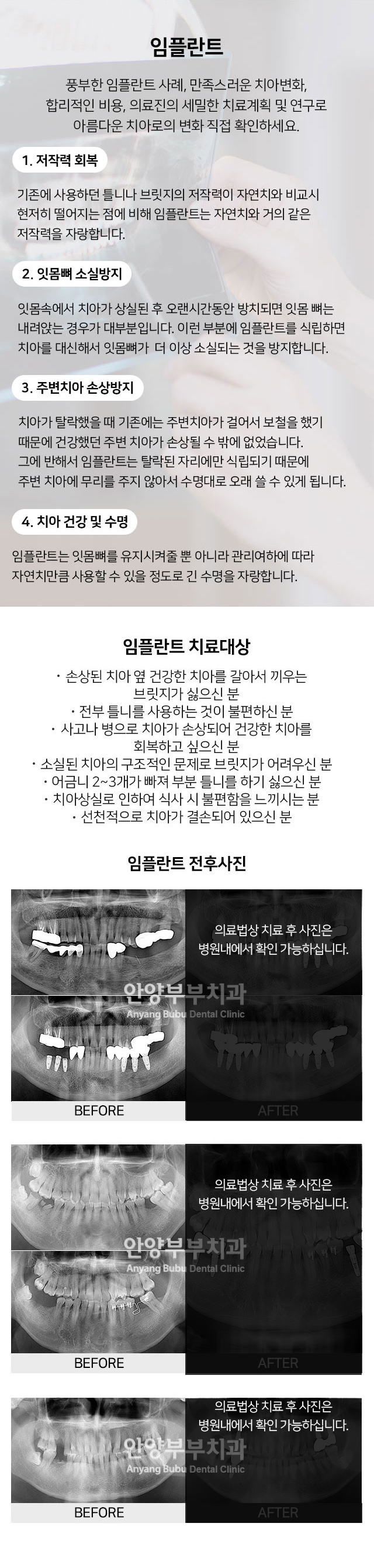 임플란트 하단