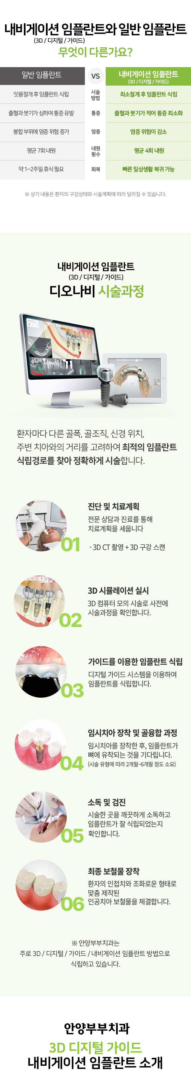 임플란트 상단